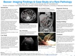 Bezoar: Imaging Findings & Case Study of a Rare Pathology