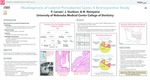 Misdiagnosis of Lateral Periodontal Cysts: A Retrospective Study by Piper Larson, John Huebner, and Nagamani Narayana