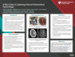 A Rare Case of Lightning-Induced Intracerebral Hemorrhage by Shalmali Mirajkar, Mitchell Floura, Steven Phillips, Daryl Gress, and Subin Mathew