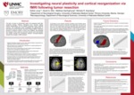 Investigating Neural Plasticity and Cortical Reorganization via fMRI Following Tumor Resection