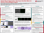 Skeletal Muscle Regeneration: Electrospun Nanofiber Matrix for Delivery of Novel Myogenic Agents